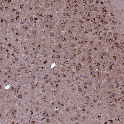 GORASP2 Recombinant Rabbit mAb (S-2526-47)