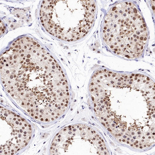 PSME4 Recombinant Rabbit mAb (S-3132-44)