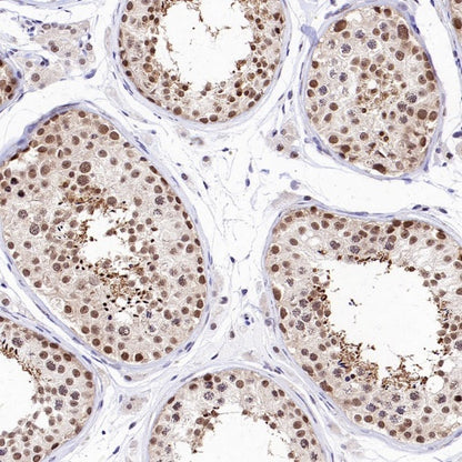 PSME4 Recombinant Rabbit mAb (S-3132-44)