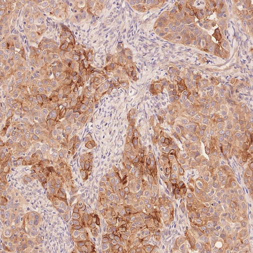 RB1CC1 Recombinant Rabbit mAb (S-2367-251)