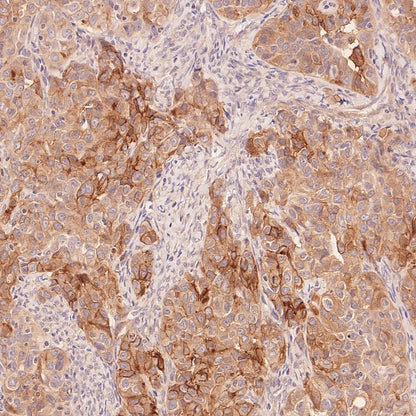 RB1CC1 Recombinant Rabbit mAb (S-2367-251)