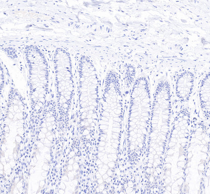 S-RMab® Cytokeratin 7 Recombinant Rabbit  mAb,PBS Only (SDT-121-17)