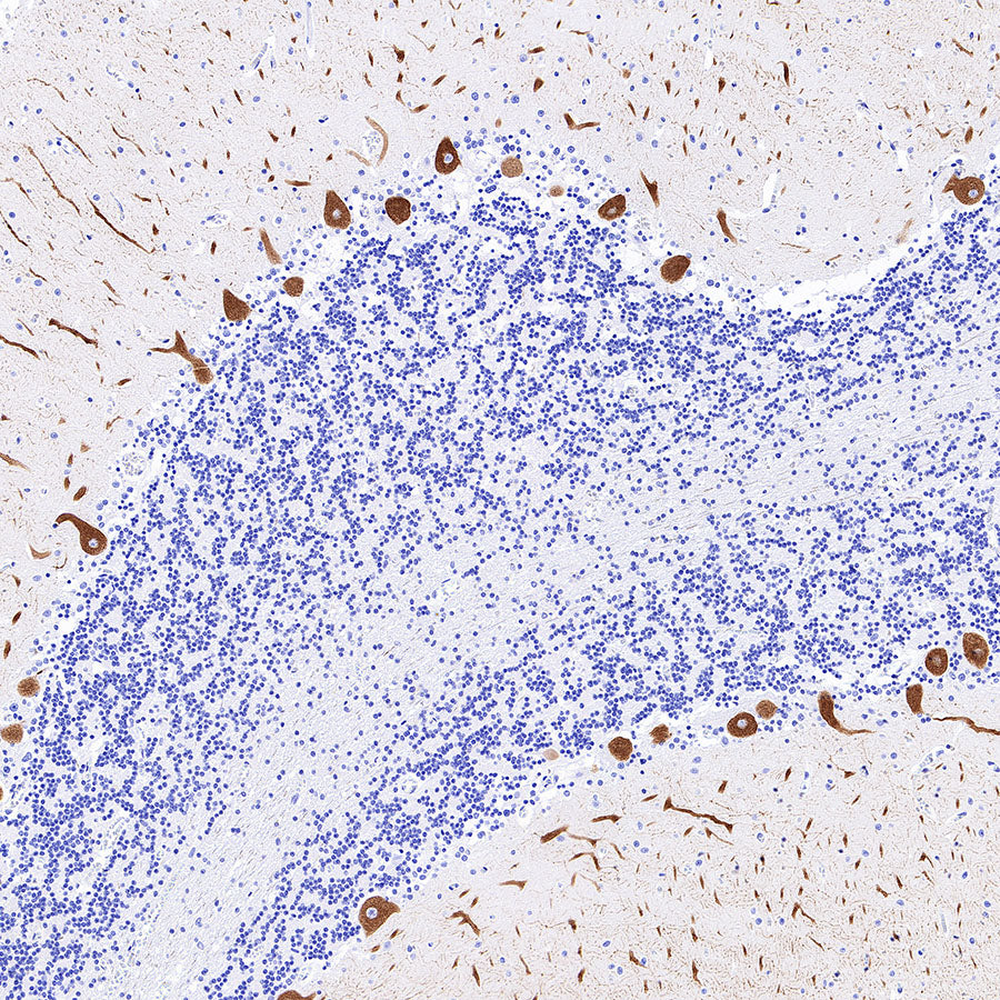 ITPR1 Recombinant Rabbit mAb (S-4530-47)