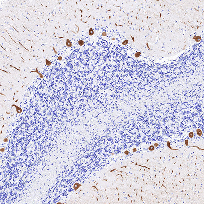 ITPR1 Recombinant Rabbit mAb (S-4530-47)