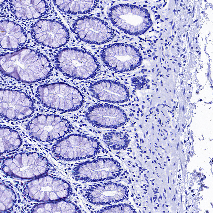MYBPC3 Recombinant Rabbit mAb (S-5476)