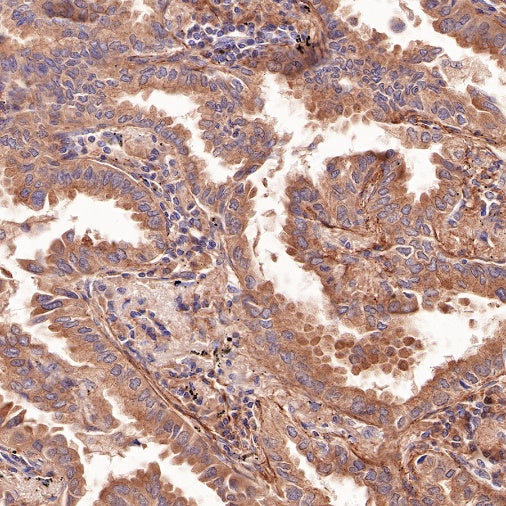 PI3 Kinase p85 Recombinant Rabbit mAb (SDT-R108)