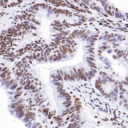 KDM5D Recombinant Rabbit mAb (S-1577-128)