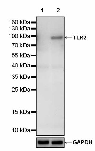 TLR2 Recombinant Rabbit mAb (S-2585-57)