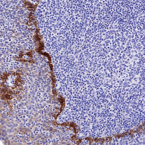 Integrin beta 6 Recombinant Rabbit mAb (SDT-1445-78)