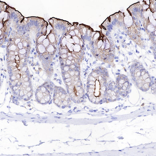 Ezrin Recombinant Rabbit mAb (S-R358)