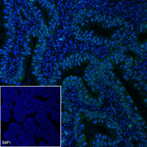 MSH2 Recombinant Rabbit mAb (Alexa Fluor® 488 Conjugate) (SDT-037-20)