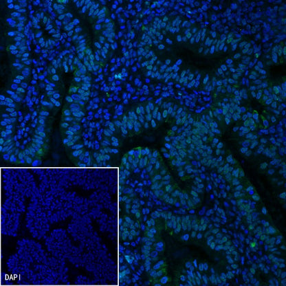 MSH2 Recombinant Rabbit mAb (Alexa Fluor® 488 Conjugate) (SDT-037-20)