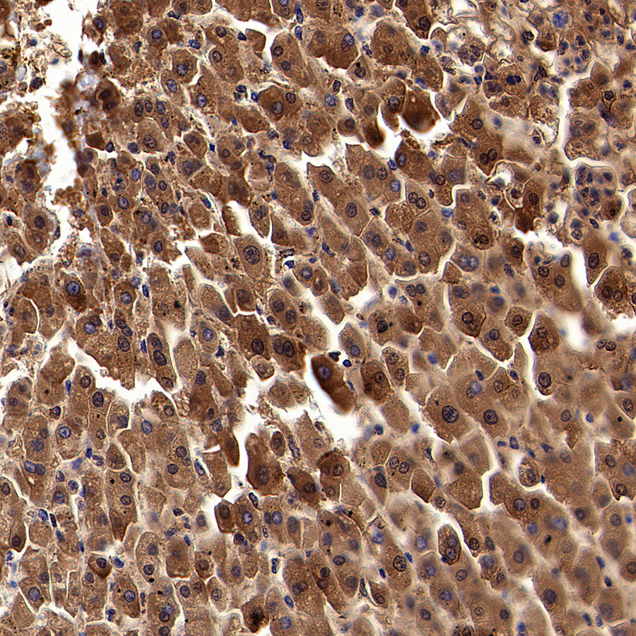 ALDH9A1 Recombinant Rabbit mAb (S-4115-48)