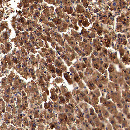 ALDH9A1 Recombinant Rabbit mAb (S-4115-48)