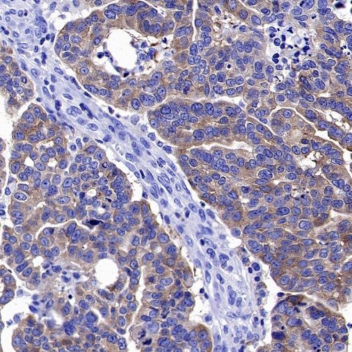 PKC zeta Recombinant Rabbit mAb (S-1306-34)