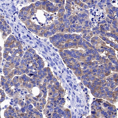 PKC zeta Recombinant Rabbit mAb (S-1306-34)