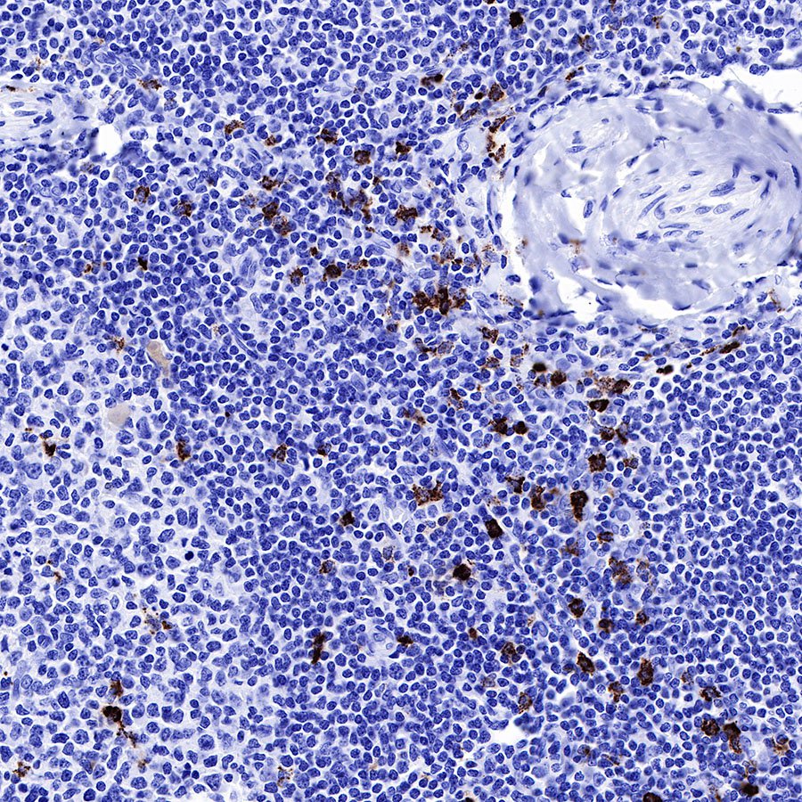 MPO Recombinant Rabbit mAb (SDT-224-19)