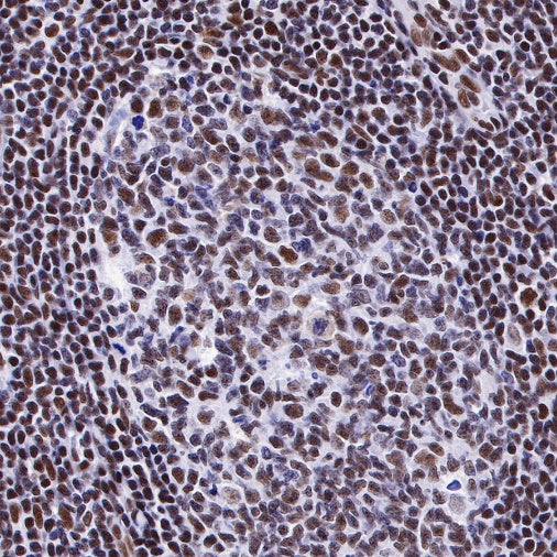 Ku80 Recombinant Rabbit mAb (S-R226)
