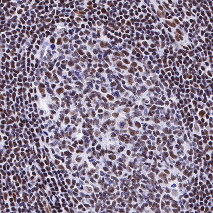 Ku80 Recombinant Rabbit mAb (S-R226)