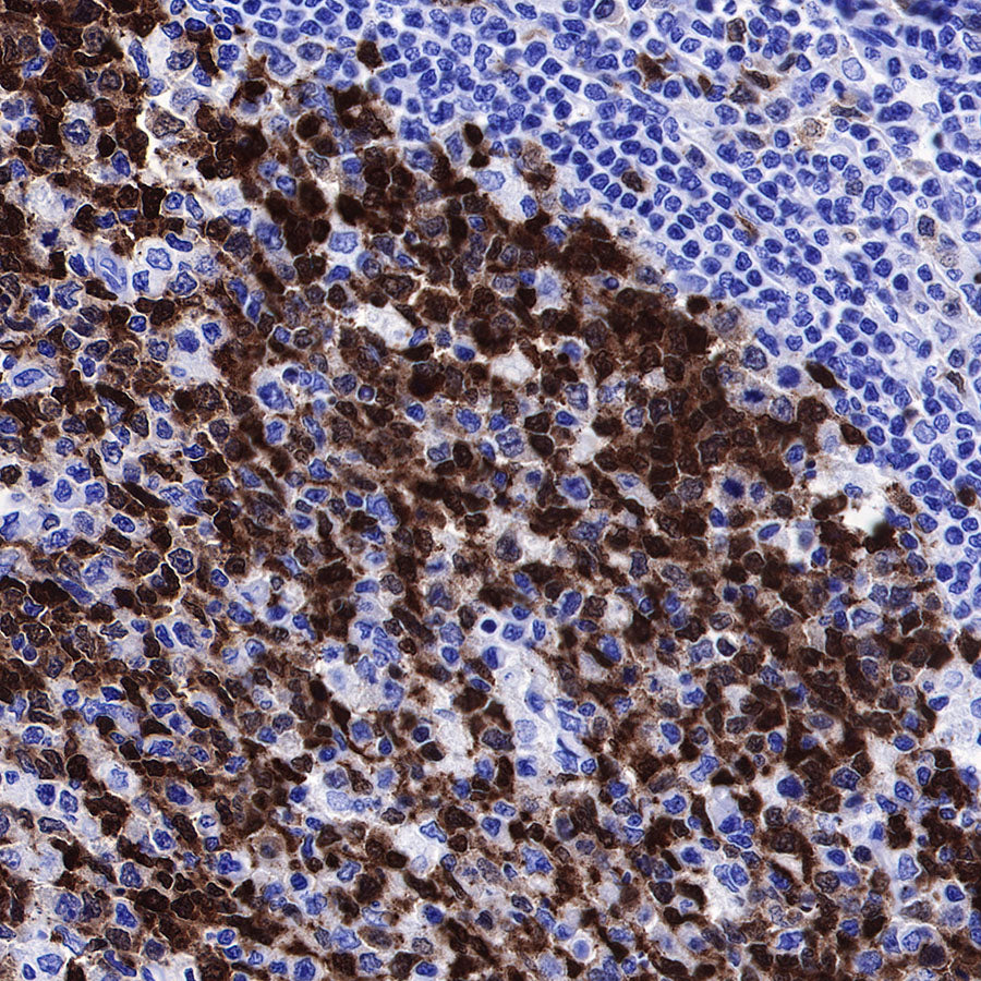 Stathmin 1 Recombinant Rabbit mAb (SDT-383-4)