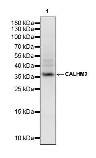 CALHM2 Recombinant Rabbit mAb (S-2671-146)