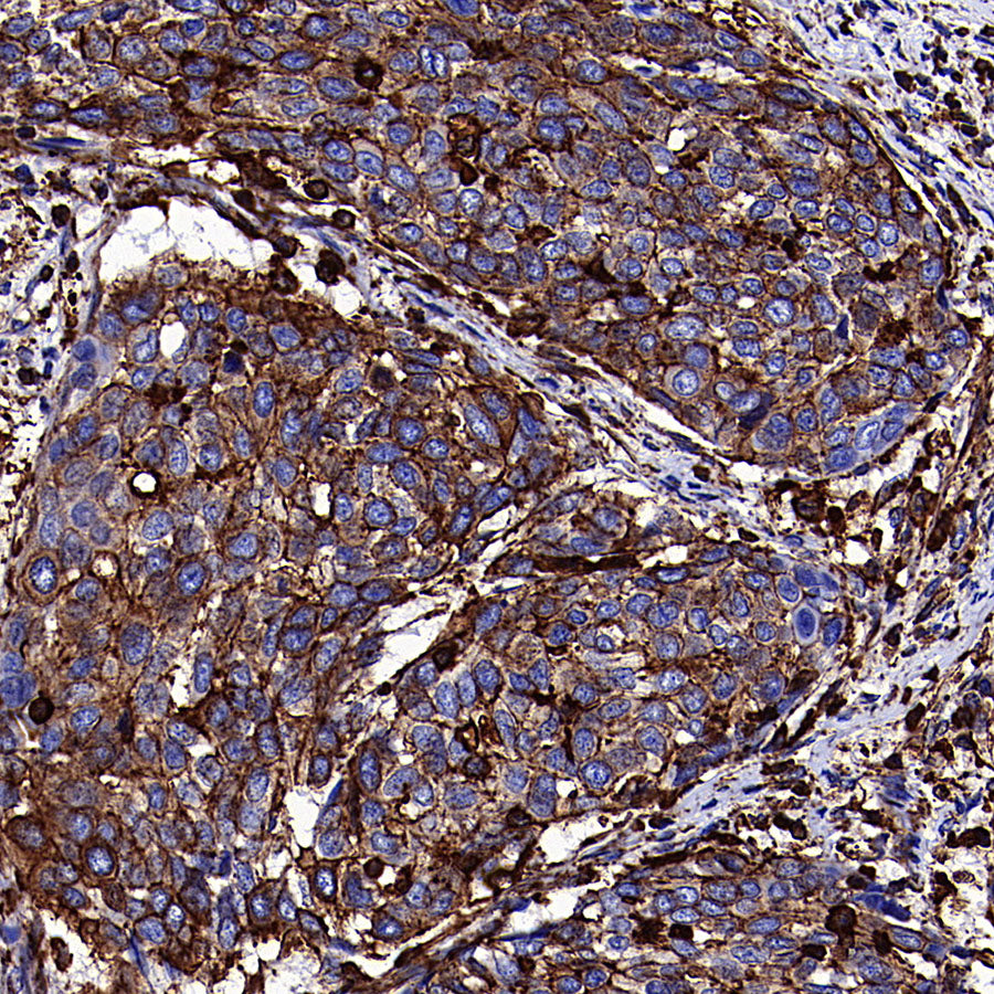 β-Actin Recombinant Rabbit mAb (S-5701)