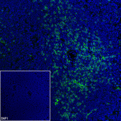 CD8α Recombinant Rabbit mAb (S-6201)