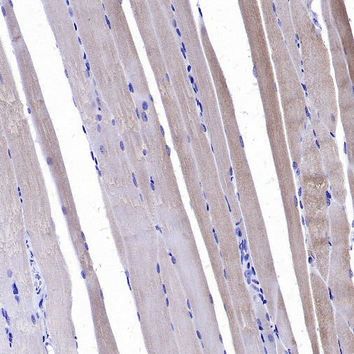CACNA1S Recombinant Rabbit mAb (S-2448-78)