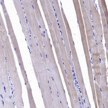 CACNA1S Recombinant Rabbit mAb (S-2448-78)