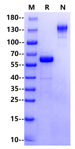 Prolactin R/PRLR Fc Chimera Protein, Human