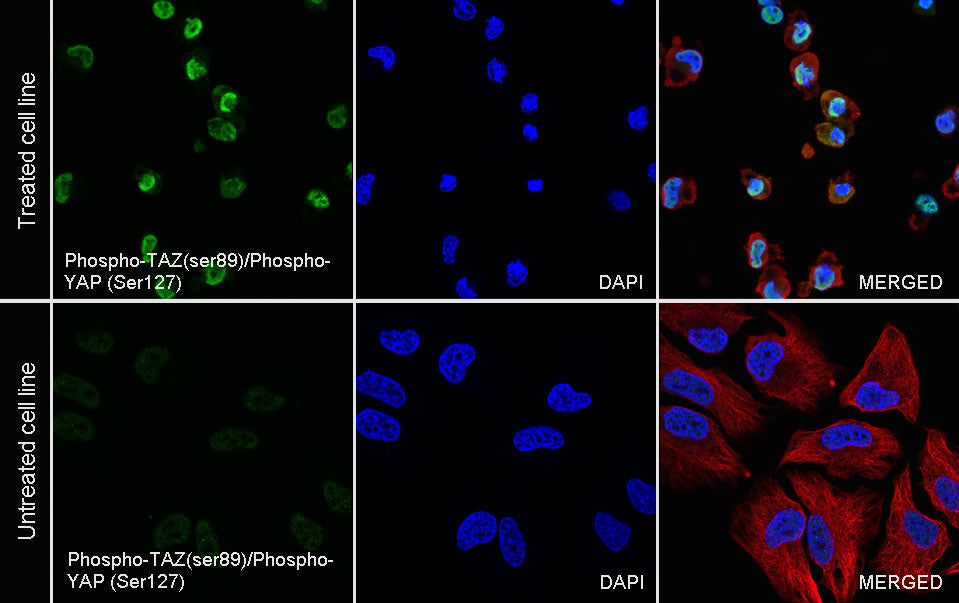 Phospho-TAZ (ser89)/Phospho-YAP (Ser127) Recombinant Rabbit mAb (S-1364-129)