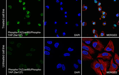Phospho-TAZ (ser89)/Phospho-YAP (Ser127) Recombinant Rabbit mAb (S-1364-129)