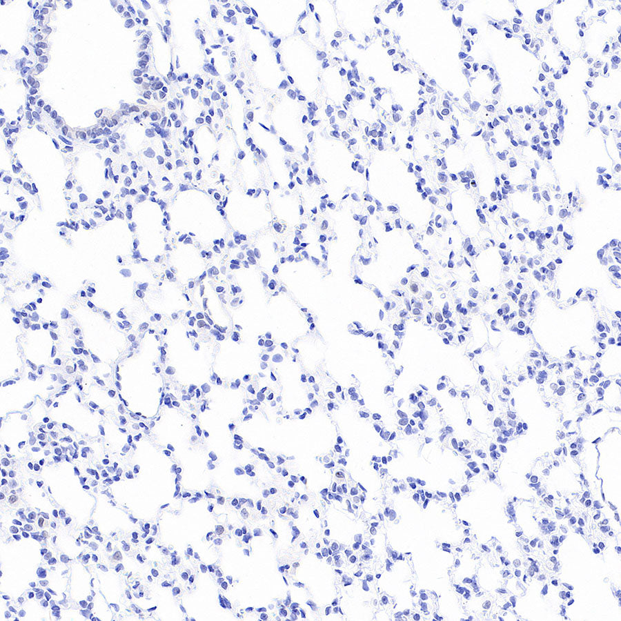 Homer1 Recombinant Rabbit mAb (S-3405-360)