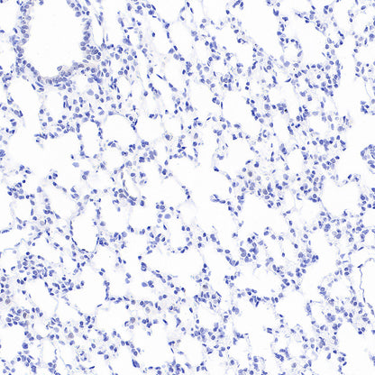 Homer1 Recombinant Rabbit mAb (S-3405-360)