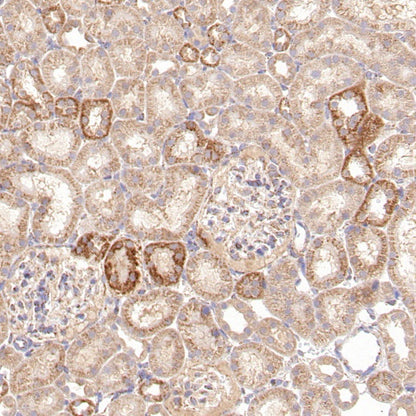 Thioredoxin/TRX Recombinant Rabbit mAb (S-1862-26)
