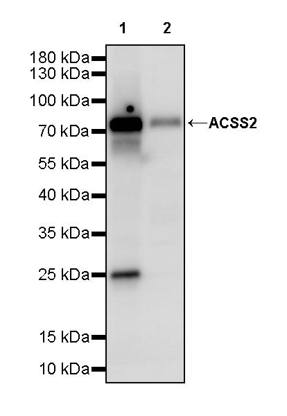 ACSS2 Recombinant Rabbit mAb (S-4117-9)