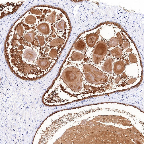 KLK2 Recombinant Rabbit mAb (SDT-4461-19)