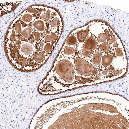 KLK2 Recombinant Rabbit mAb (SDT-4461-19)