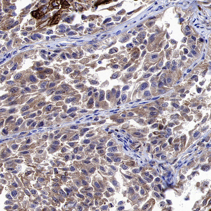 YTHDC2 Recombinant Rabbit mAb (S-3338-41)