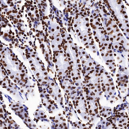 Histone H2B Recombinant Rabbit mAb (S-R214)