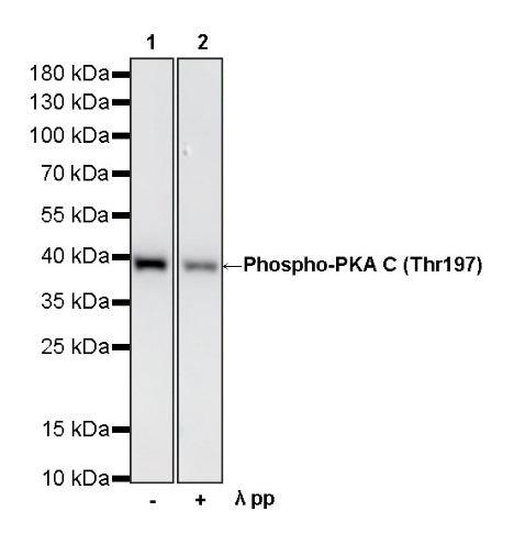 Phospho-PKA C (Thr197) Recombinant Rabbit mAb (S-5959)