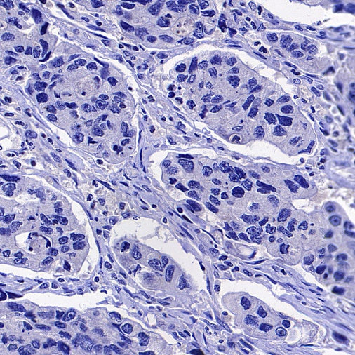 Coagulation factor V Recombinant Rabbit mAb (S-4489-58)