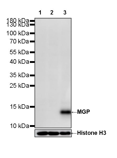 MGP Recombinant Rabbit mAb (S-4734-35)