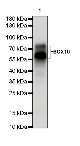 S-RMab® SOX10 Recombinant Rabbit mAb (SDT-R233)
