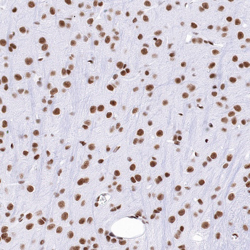 CREB Recombinant Rabbit mAb (S-1115-39)