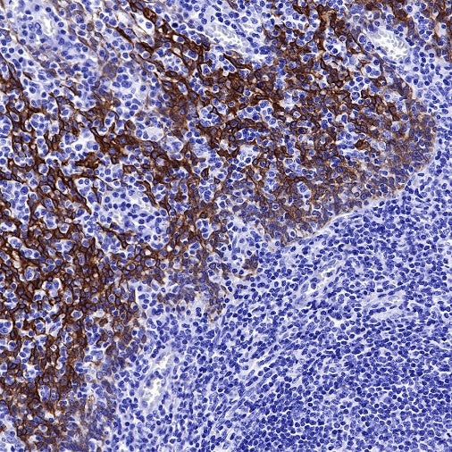CK-13 Recombinant Rabbit mAb (SDT-641-41)