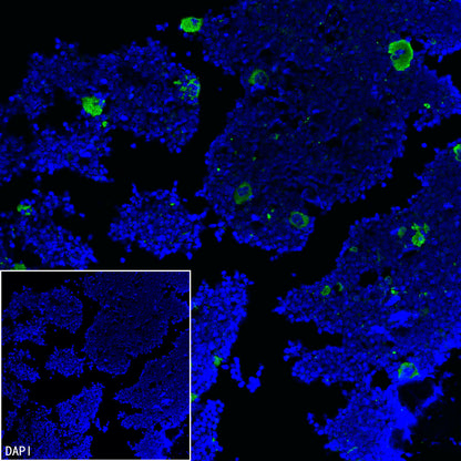Thrombospondin 1 Recombinant Rabbit mAb (S-4153-22)