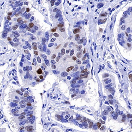 Cyclin D1 Recombinant Rabbit mAb (SDT-R423)