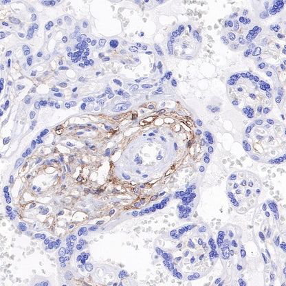 Tissue factor Recombinant Rabbit mAb (S-893-34)