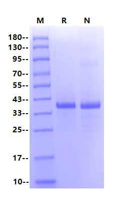 IRAK4 His Tag Protein, Human